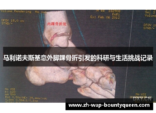 马利诺夫斯基意外脚踝骨折引发的科研与生活挑战记录